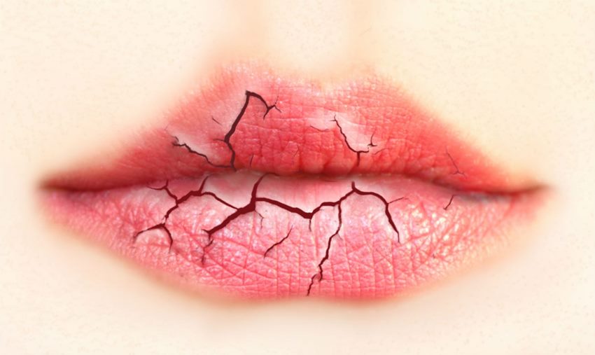 Отличия здоровых губ от пересушенных