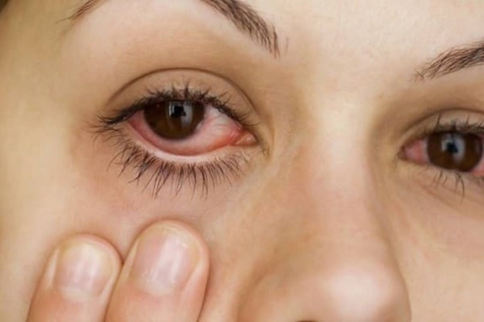 Почему многие женщины считают, что у них чувствительные к наращиванию ресниц глаза