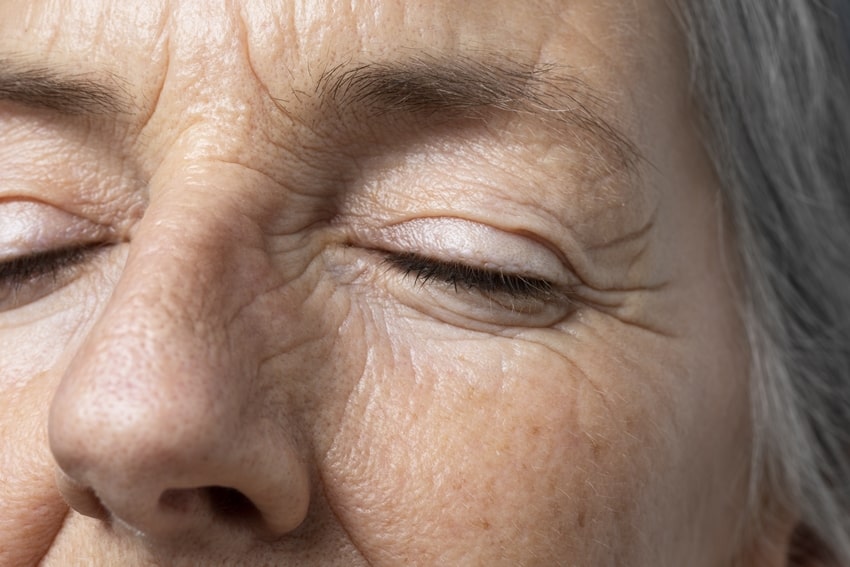 почему кожа вокруг глаз стареет быстрее