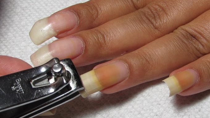 Как предотвратить появление загибающихся ногтей