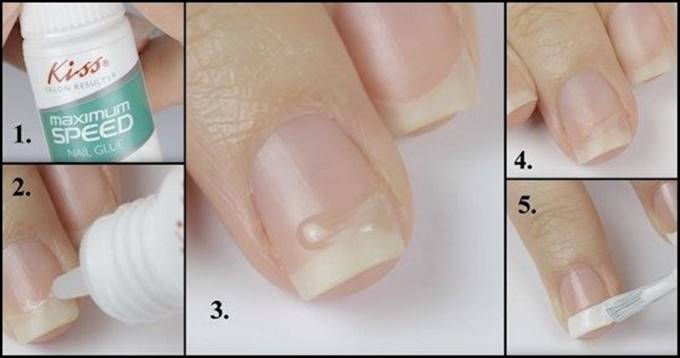 Восстановление ногтя с помощью специального клея