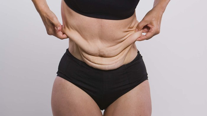 Причины появления обвисшего живота после похудения
