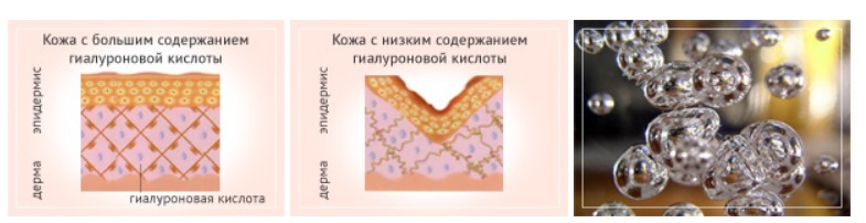 Причины обезвоживания кожи
