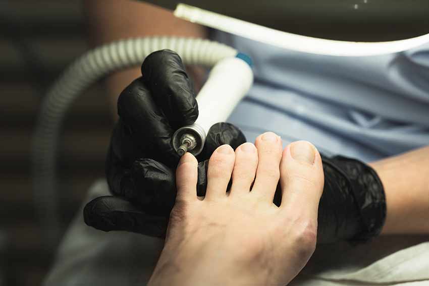 Аппаратный (медицинский) педикюр для мужчин