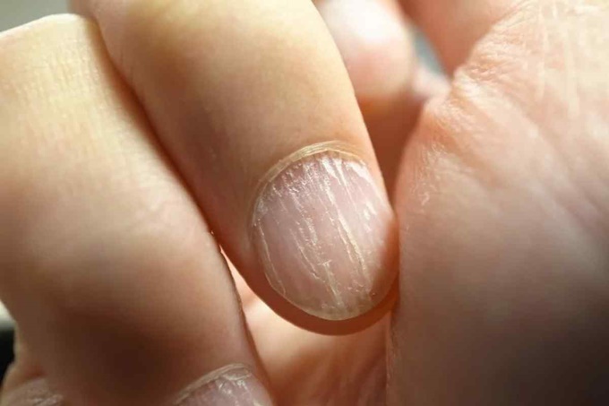 Как укрепить ногти и сделать так, чтобы гель-лак держался дольше?