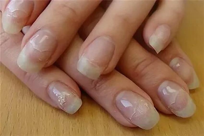 Как реанимировать ногтевую пластину после снятия наращенных ногтей
