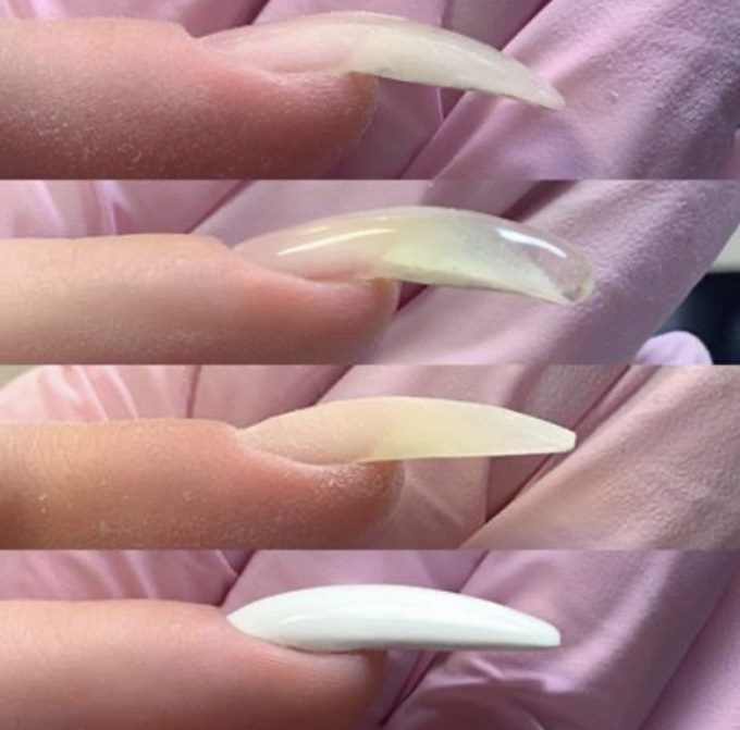 Народные методы избавления от клюющего ногтя