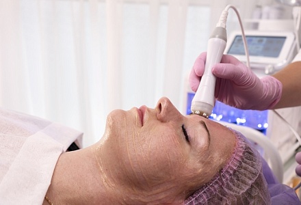Фракционно-лазерное омоложение: преимущества и побочные эффекты