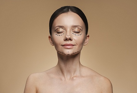 Моделирование овала лица: методы, возможный эффект, преимущества процедуры