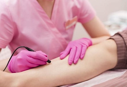 Электроэпиляция: эффективность, плюсы и минусы