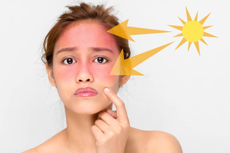 Влияние солнца на кожу