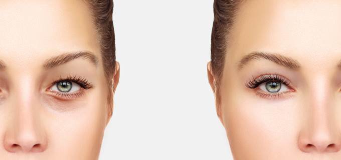 Как скорректировать форму глаз с помощью макияжа