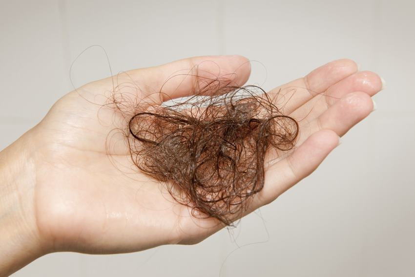 Причины, почему сильно выпадают волосы