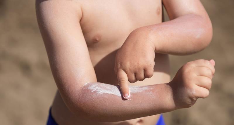 Способы восстановления кожи после солнечных ожогов