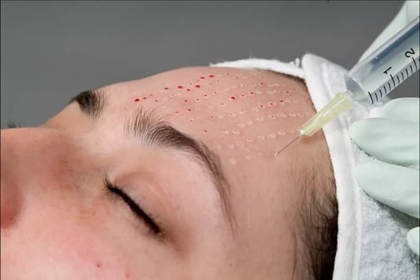 Инъекционные виды процедур для кожи лица