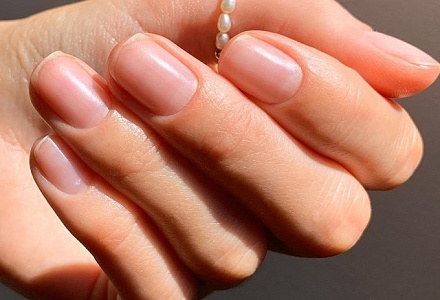 Лунки на ногтях: как связаны со здоровьем